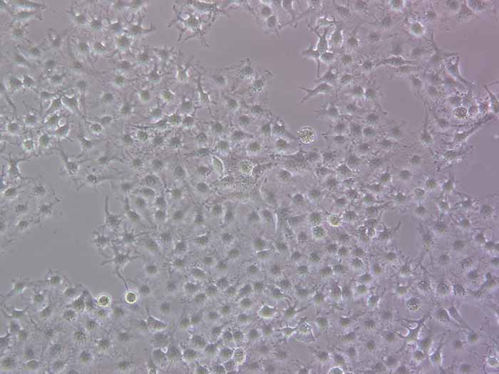 HuH7细胞图片
