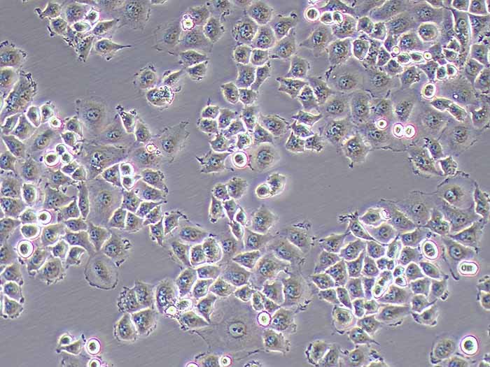 5-8F细胞细胞图片