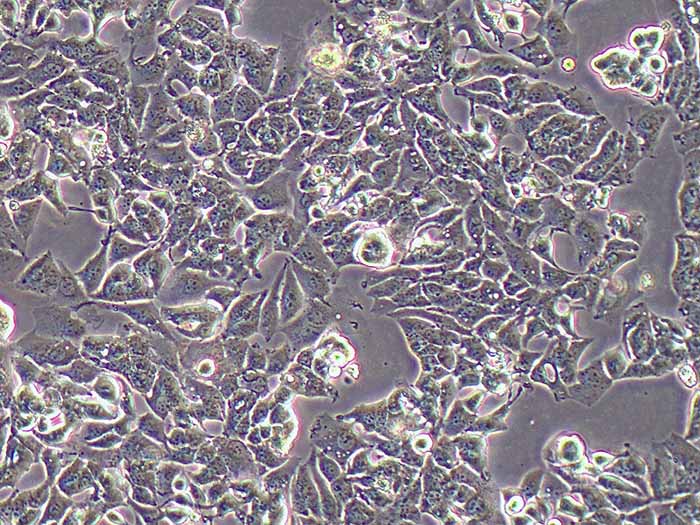 MHCC-97H细胞细胞图片