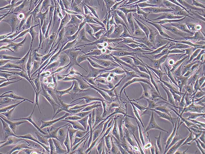SK-MEL-28细胞细胞图片