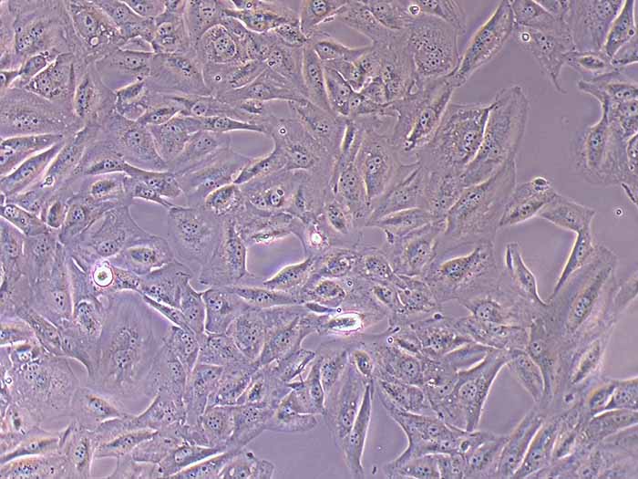 FTC-133细胞细胞图片
