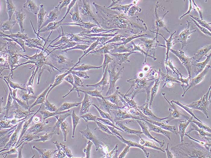 SNB-19细胞细胞图片