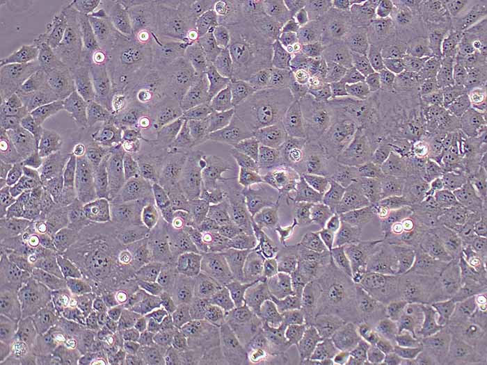 Caco-2细胞细胞图片