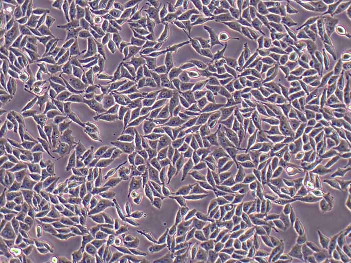 RKO细胞细胞图片