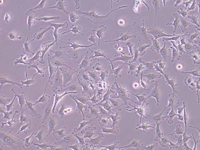 U251MG细胞图片