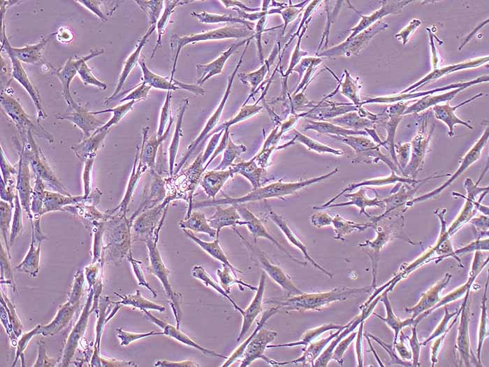 U-118 MG细胞细胞图片