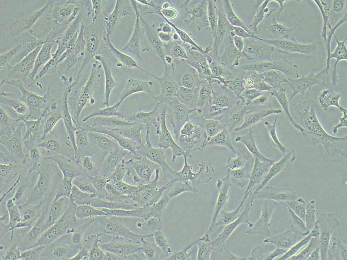 J82细胞细胞图片