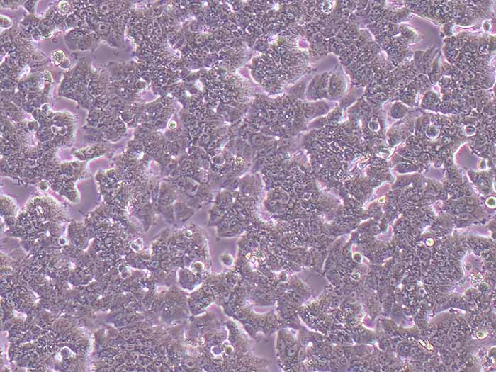 T47D细胞细胞图片