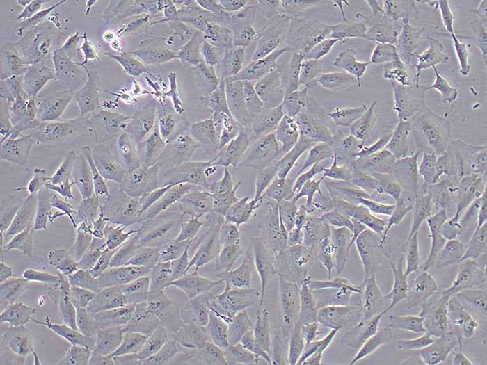 MCF-10A细胞(人乳腺上皮细胞)(STR鉴定正确）-逸漠细胞库