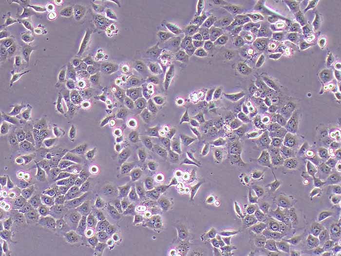 CAL-27细胞细胞图片
