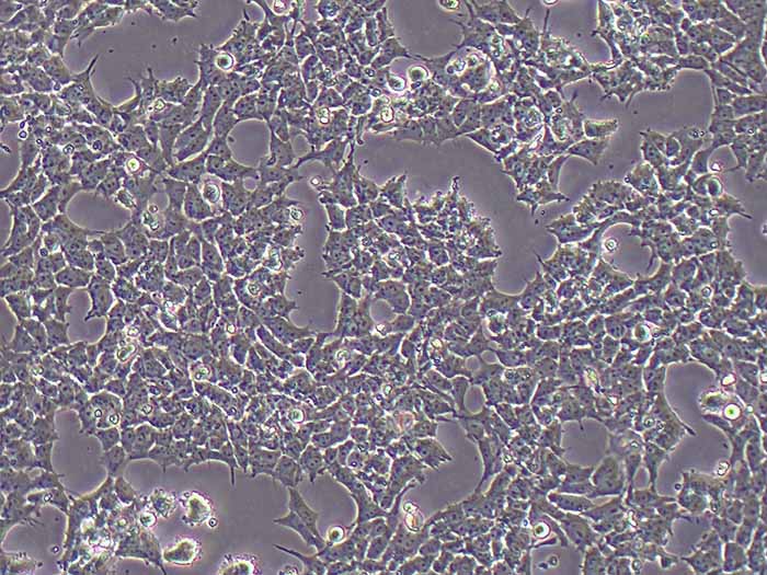 SK-N-MC细胞细胞图片