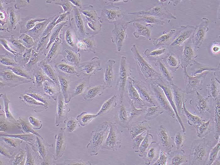 A498细胞(人肾癌细胞)(STR鉴定)-逸漠细胞库