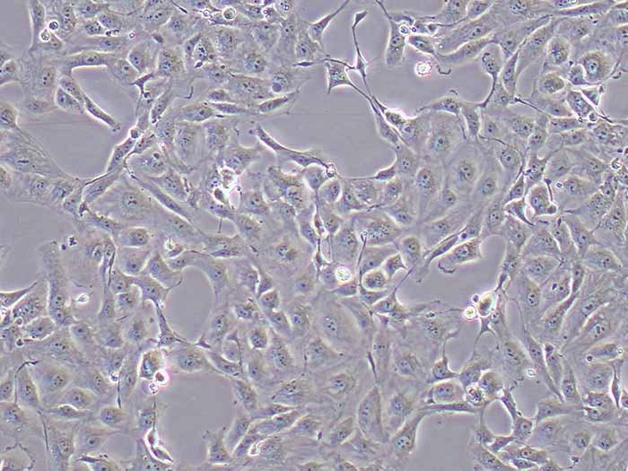 769-P细胞细胞图片