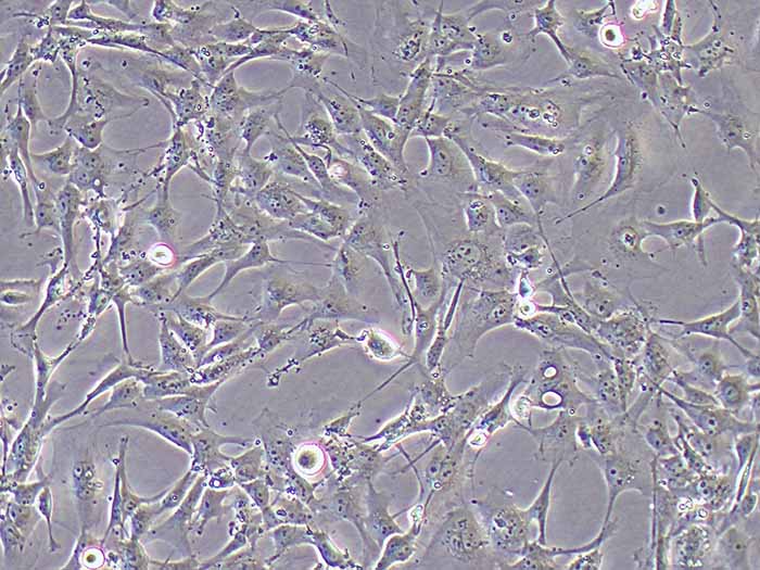 人视网膜微血管内皮细胞图片