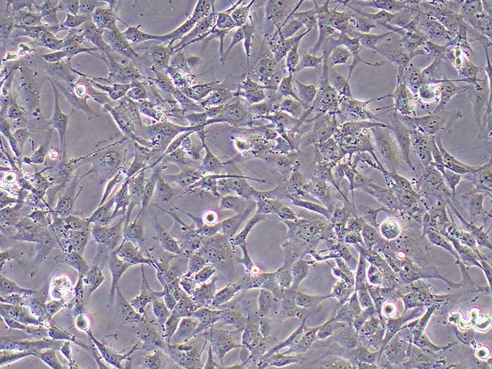 HRCEC细胞图片
