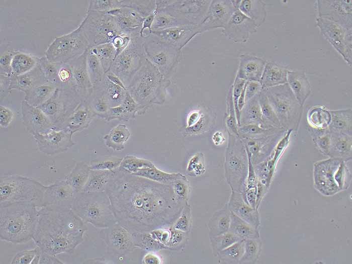 MKN-7细胞图片