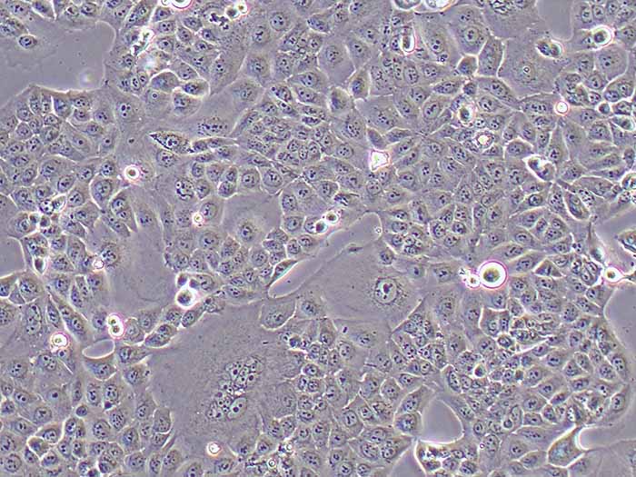 MKN-28细胞细胞图片