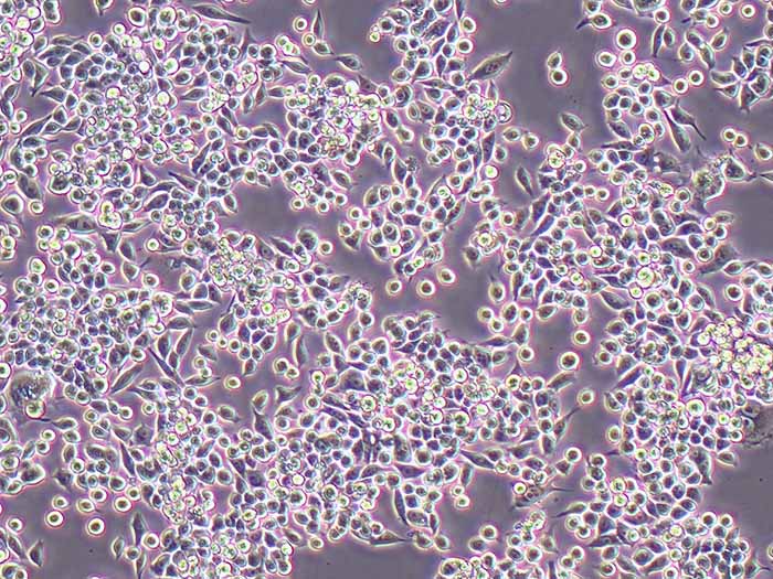 MKN-45细胞细胞图片