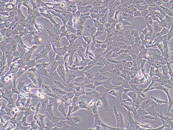NCI-H157细胞图片