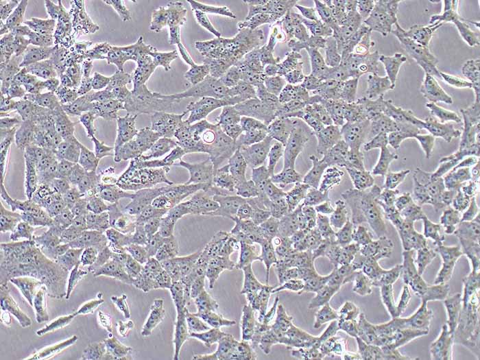 NCI-H157细胞细胞图片