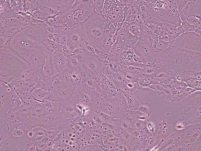 SW1990细胞细胞图片