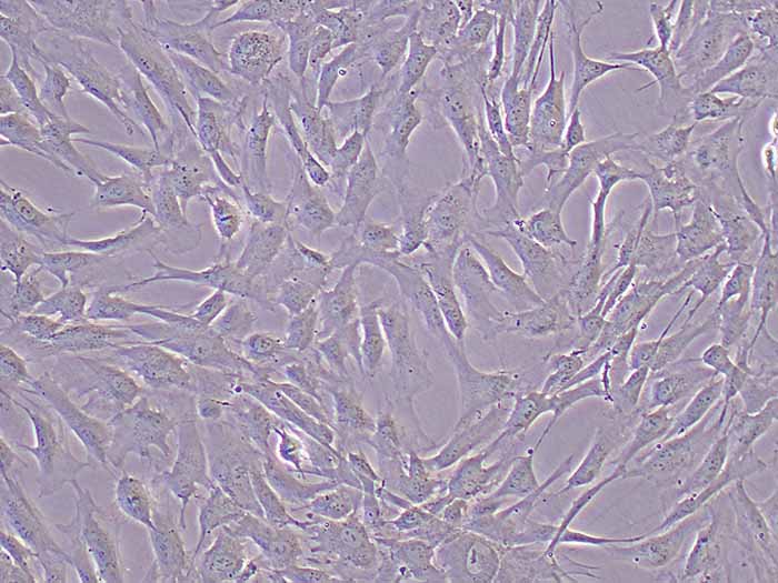 hTERT-HPNE细胞图片