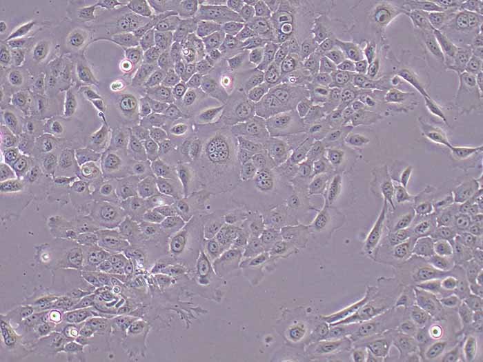 RWPE-1细胞细胞图片