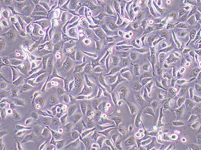 HEEC细胞细胞图片
