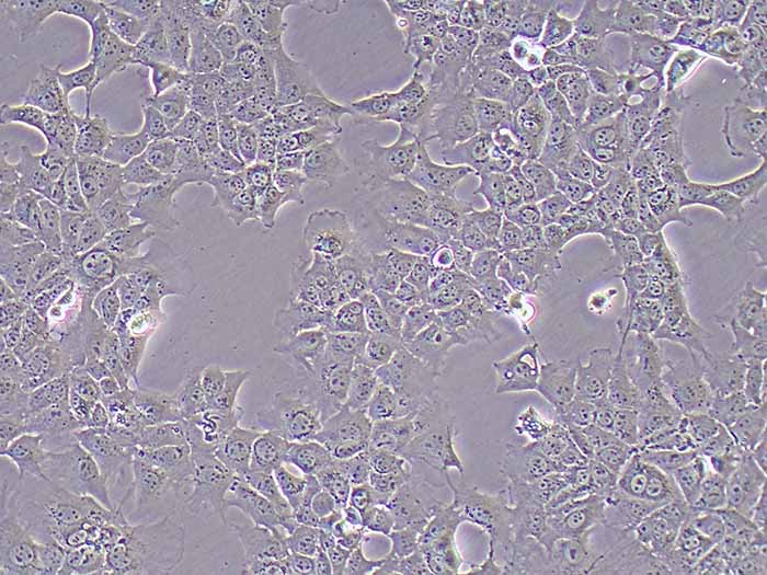AML-12细胞细胞图片