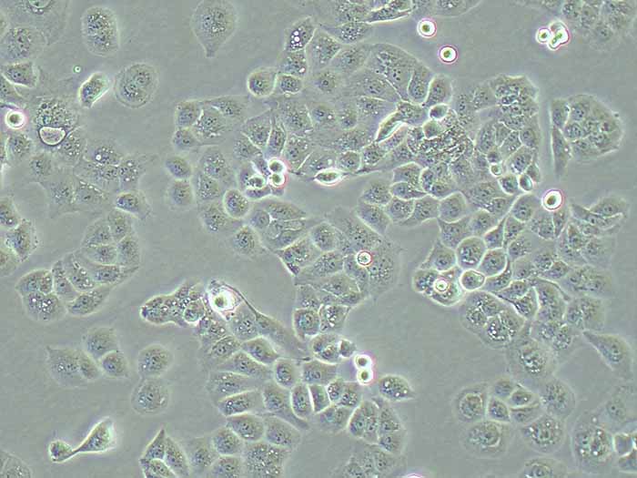 HEC-1-A人子宫内膜腺癌细胞（STR鉴定正确）