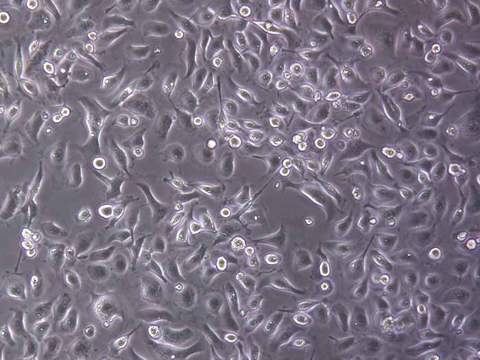 CNE1细胞细胞图片