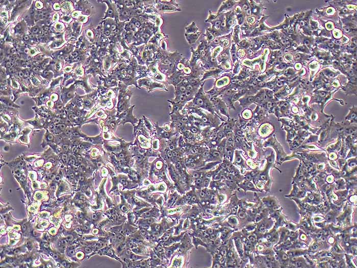 NCI-H1395细胞图片