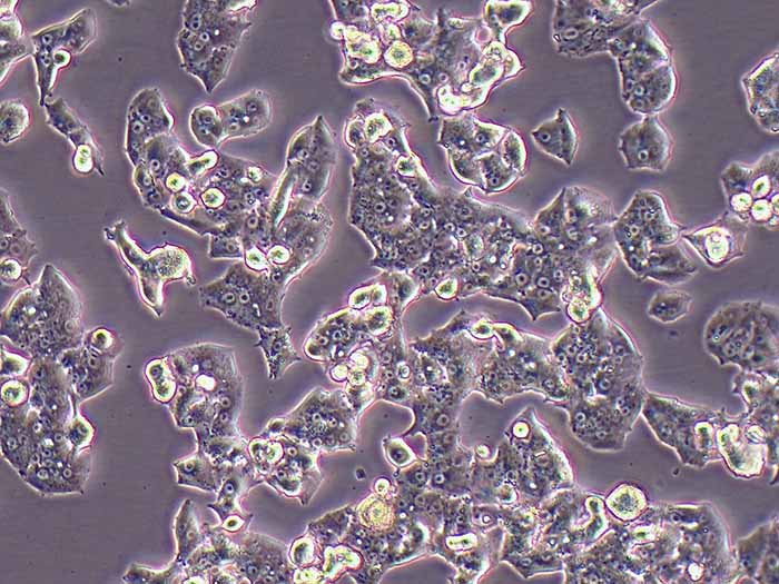 NCI-H1395细胞图片