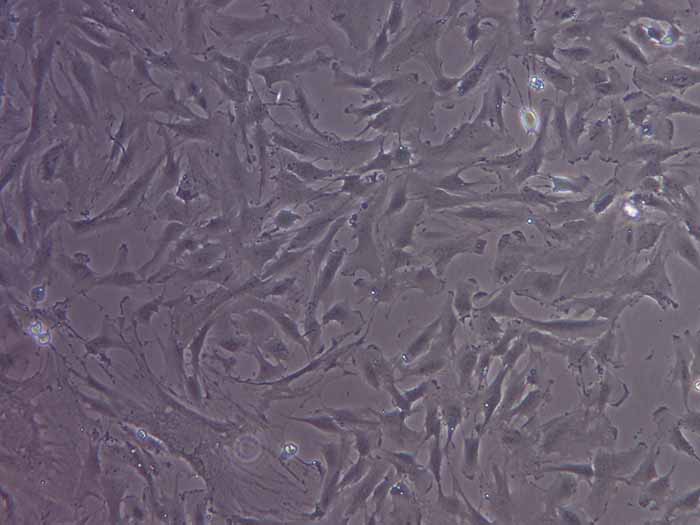 人卵巢颗粒细胞系图片