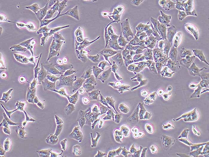 HCC-LM3细胞细胞图片