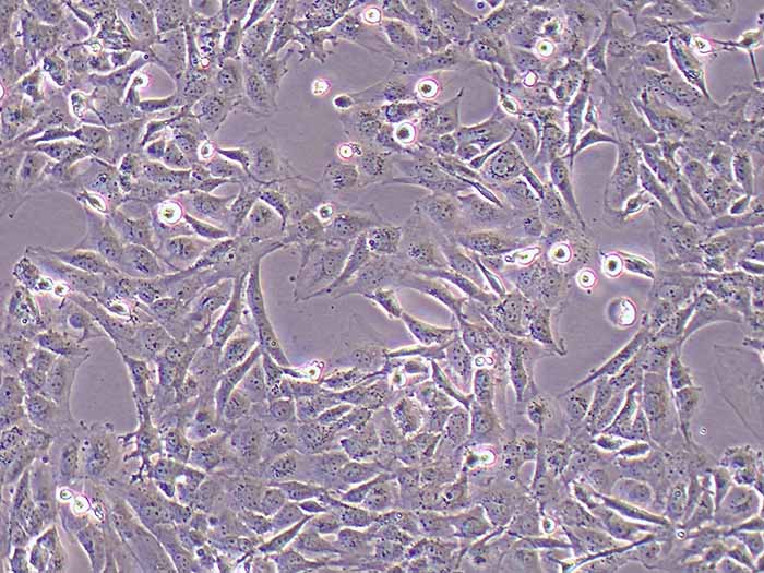 MET-5A细胞图片