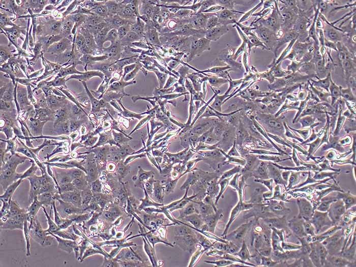 SK-MEL-2细胞细胞图片