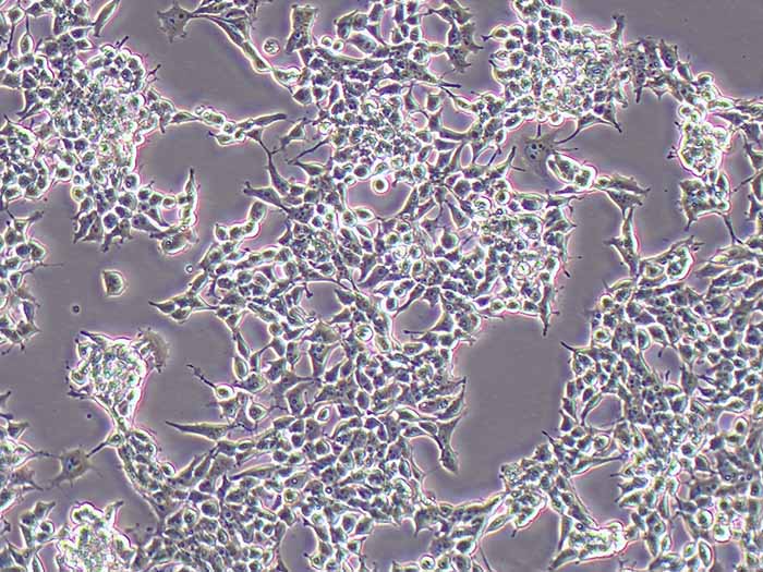 SNU398细胞细胞图片