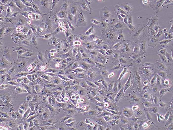 SNU449细胞细胞图片