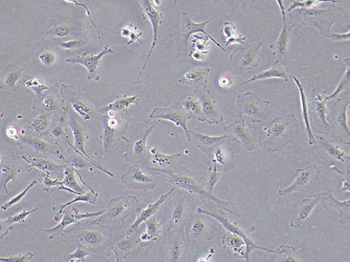 LX-2细胞细胞图片
