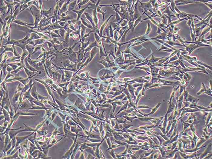 B16细胞细胞图片