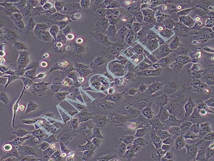 BT-549细胞细胞图片
