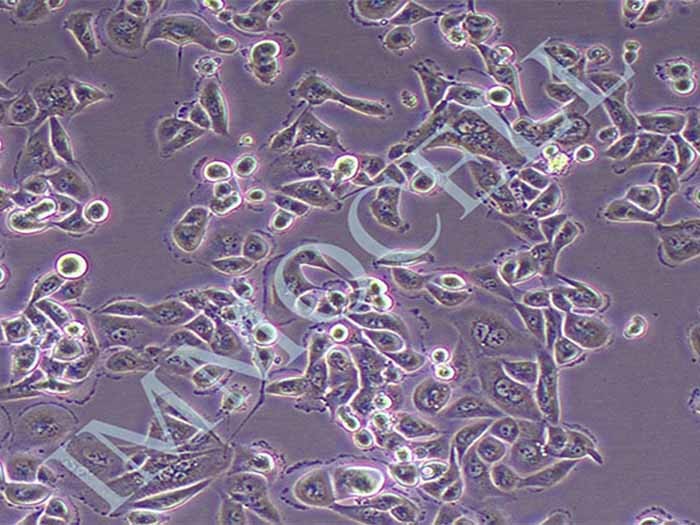 ACHN细胞细胞图片