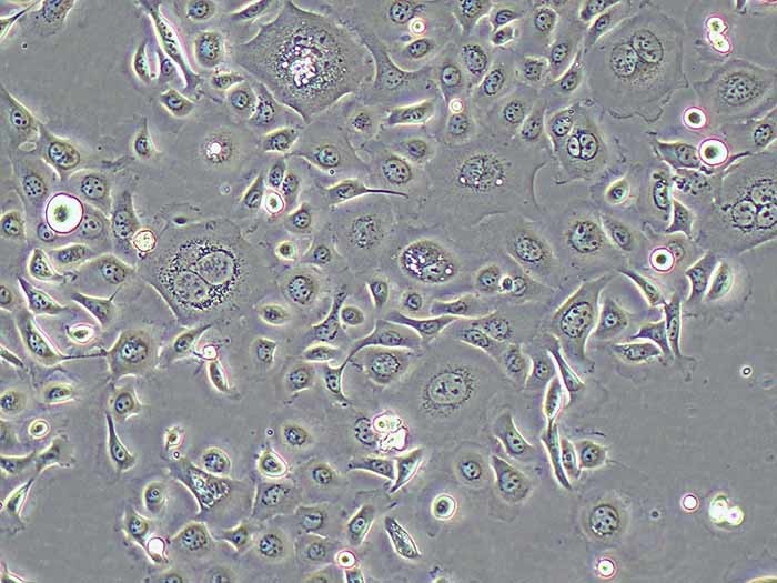 TE-1细胞细胞图片