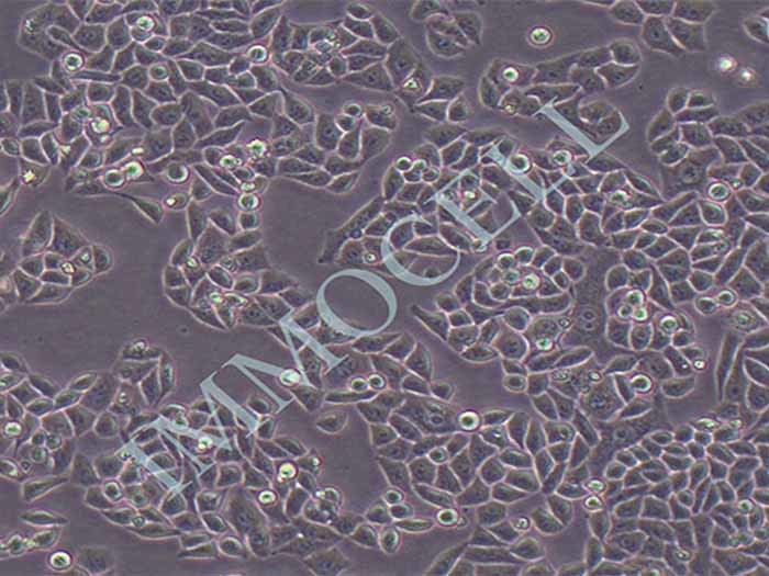 Eca-109细胞细胞图片