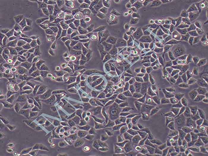 Eca-109细胞图片