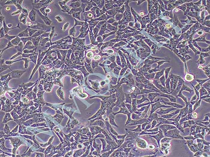 VCaP细胞细胞图片