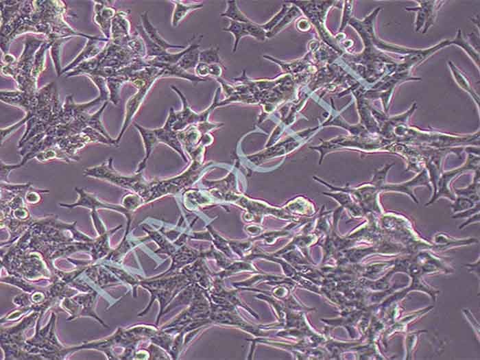 LNCaP细胞细胞图片