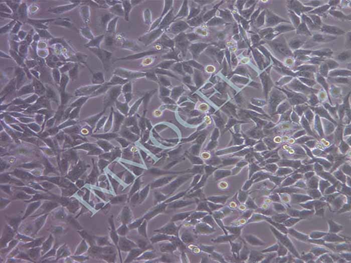 UM-UC-3细胞细胞图片