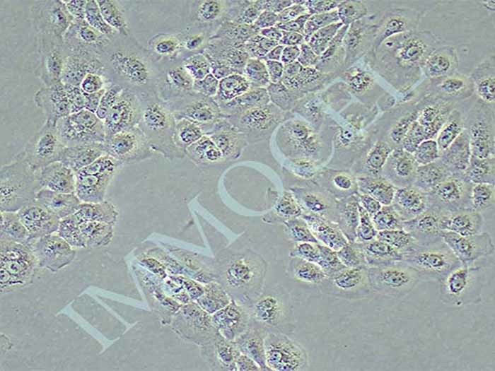 NCI-H292人肺癌细胞(淋巴结转移)图片